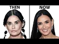 Demi Moore s NEW FACE Plastic Surgery Analysis