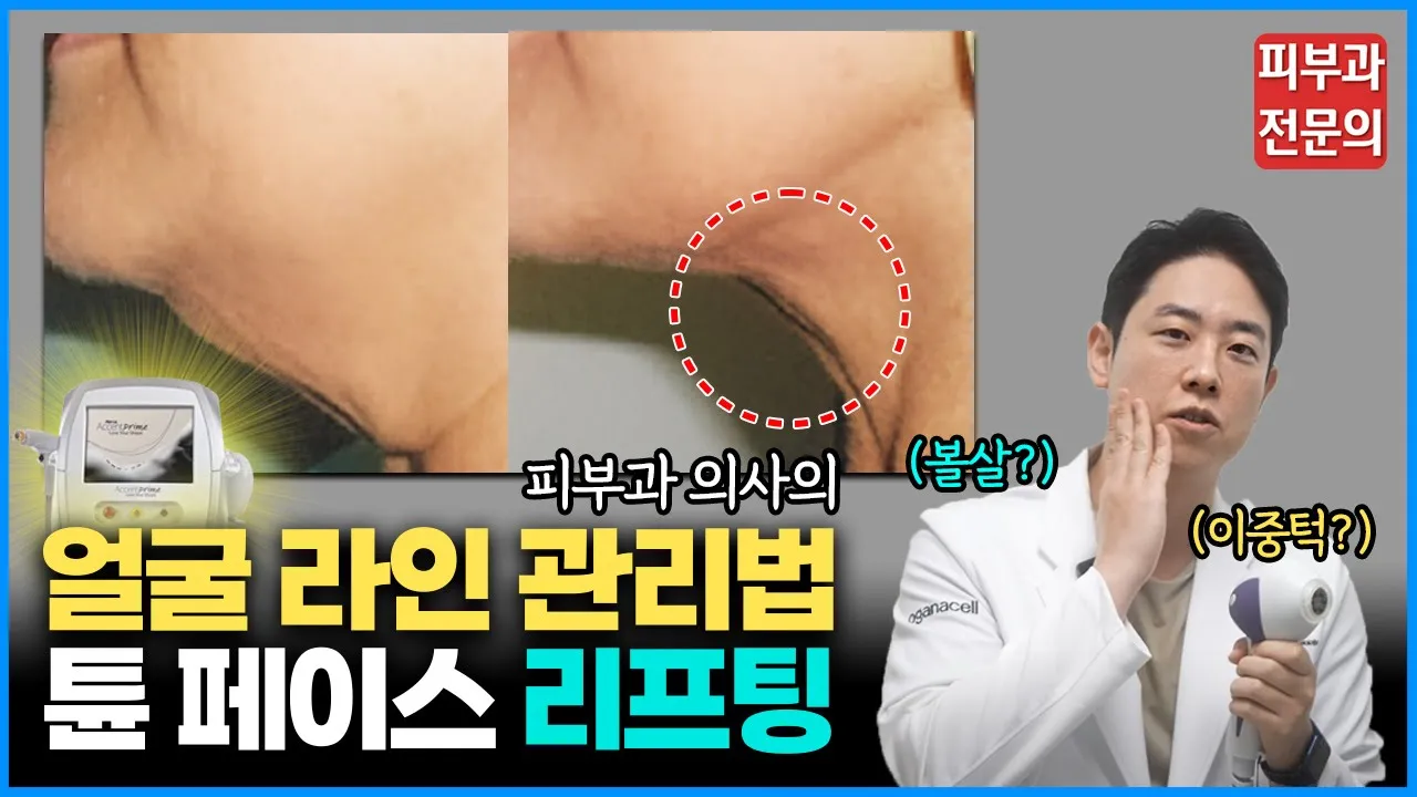 통증없는 "튠 페이스 리프팅" 제대로 관리 받는 방법 / 튠 페이스 리프팅의 모든 것
