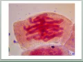 Mitosis in pictures