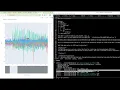 Optimizing EEG Data Visualization JavaScript Plotly vs Chart js and Python Backend