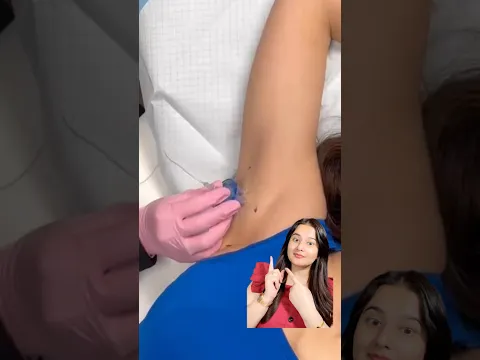 Under arm roll on to remove darkness