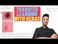 Transfer Learning Using CNN VGG 16 Keras Tutorial