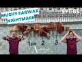 Deep Ear Wax Removal Compilation Microsuction Irrigation - EP1169