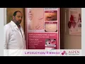 Liposuction Contour Irregularity Stubborn Lipo Lumps and Bumps Treatment