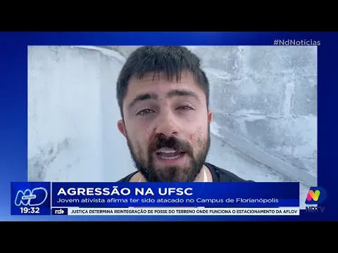Agressão na UFSC: jovem ativista afirma ter sido atacado no Campus de Florianópolis