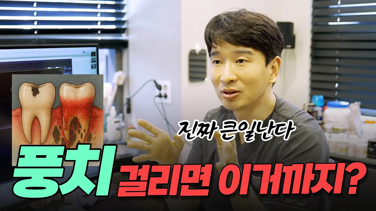 풍치 걸리면 이거까지 해야 된다고? #풍치 #풀아치임플란트