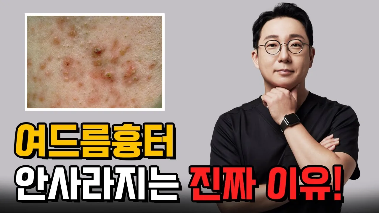 여드름 흉터, 왜 시간이 지나도 사라지지 않을까요? ⏱ │여드름흉터