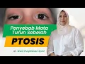 Lagu KELOPAK MATA TURUN SEBELAH PENYEBAB MATA MALAS ( PTOSIS ) - VIO OPTICAL CLINIC