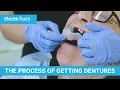 The stages of getting a denture false teeth