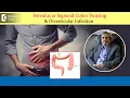 Colon Problems Diverticular Disease in Sigmoid Colon - Dr Rajasekhar MR Doctors Circle