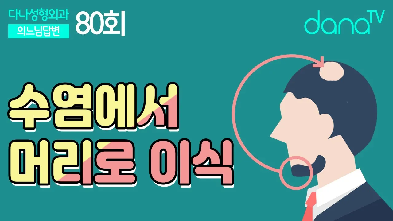 의느님답변📂ㅣ수염에서 머리로 이식, 의느님답변 80회