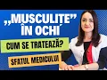 Download Lagu „Musculițe” în ochi. De ce apare și ce trebuie să faci?