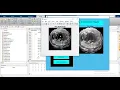 Cloud Tracking from Whole Sky Ground Image Matlab Projects