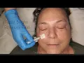 Glytone Triple Bright Renewal Hand Peel Glytone