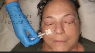 Glytone Triple Bright Renewal Hand Peel Glytone