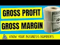 Gross Margin vs Gross Profit What is the Difference