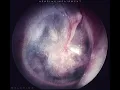 Laylow - LONGUE VIE... (MELCHIOR Edit)