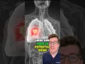 Download Lagu LONGKANKER - 12 mogelijke tekenen en symptomen #shorts #gezondheid