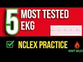 5 Most Tested EKG Rhythms on NCLEX Cardiac Strips Practice Questions Answers