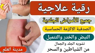رقية علاج الأمراض الجلدية والنبض والتنمل الصدفية الاكزمة تشويه الجلد بالعين والسحر يعالج بأمر الله 