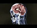 A Man Ate Pork Tacos From An Illegal Food Truck This Is What Happened To His Brain