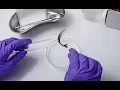 Hair Follicle Testing With Dr Dixon