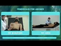 Download Lagu Pemeriksaan Fisik Abdomen - Video OSCE | HMKU FK Unud
