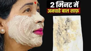 सिर्फ़ 5 मिनट में अनचाहे बालों को ऐसे हटाएगा कि दोबारा कभी वापस नहीं आएंगे Remove Unwanted Hair