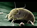 Should Rubbing Alcohol be Used to Get Rid of Dust Mites