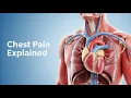 Download Lagu 💔 Approach to Chest Pain (typical) non-anginal, pericarditis, aortic dissection, anginal equivalent