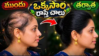 🔥 ఓపెన్ ఛాలెంజ్😱 3 రోజుల్లోనే జుట్టులో ఒక్క వెంట్రుక రాలిన చోట 10 వెంట్రుకలు వస్తాయి😍#hair