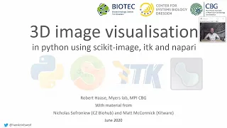 12d 3D Image Visualisation and Processing in Python using scikit-image itk and napari