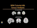 SPM Tutorial Group-Level Analysis