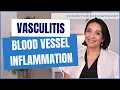 What is Vasculitis Learn about this rare but deadly autoimmune disease