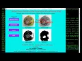 Python OpenCV Keras Project on Walnut Disease Detection Using CNN with Source Code