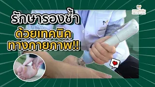 อาการปวดรองช้ำมักเริ่มต้นอย่างไร และมีลักษณะเปลี่ยนแปลงตามการเคลื่อนไหวอย่างไร