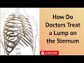 How Do Doctors Treat a Lump on the Sternum