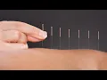 The Science Behind How Acupuncture Helps Relieve Pain A Doctor Of Chinese Medicine Explains