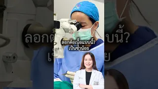 การผ่าตัดรักษาเนื้องอกที่ตา มีวิธีไหนที่ช่วยลดโอกาสกลับเป็นซ้ำได้ดีที่สุดในปัจจุบัน
