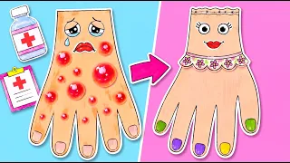😱 Una mano di carta piena di macchie?! Diventa un super dottore! 🩺✨