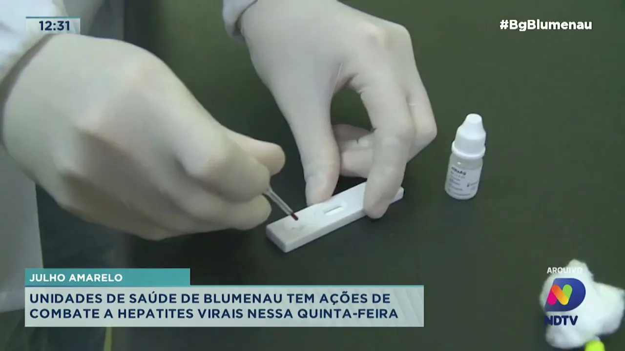Julho Amarelo: unidades de saúde de Blumenau tem ações de combate a hepatites virais