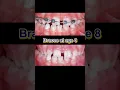Download Lagu Braces at age 8. Fix gapped teeth #braces #dentist #orthodontist
