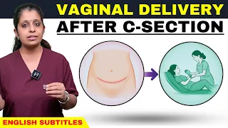 Previous C-Section? Can You Have a Vaginal Delivery?