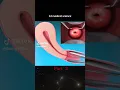 Download Lagu 3D medical care opt. #vagina #uterus #pregnancy #short