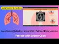 Lung Cancer Detection Using CNN Project with Source Code Python Tensorflow