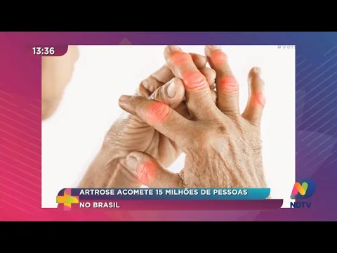 Artrose acomete 15 milhões de pessoas no Brasil