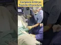 Download Lagu Complete Embryo Transfer procedure in IVF by Dr Rakshita Malik #doctor #ivf #ivfprocess #mbbs #short