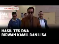 Download Lagu Polri Umumkan Hasil Tes DNA Ridwan Kamil dan Lisa Mariana Siang Ini | Liputan 6