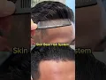 Download Lagu Skin Base Hair Patch System I 100 % Natural Look #hairreplacement #hairsystem