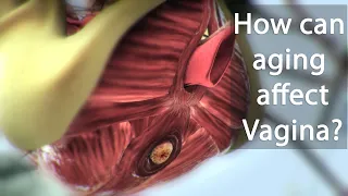 How can aging affect Vagina